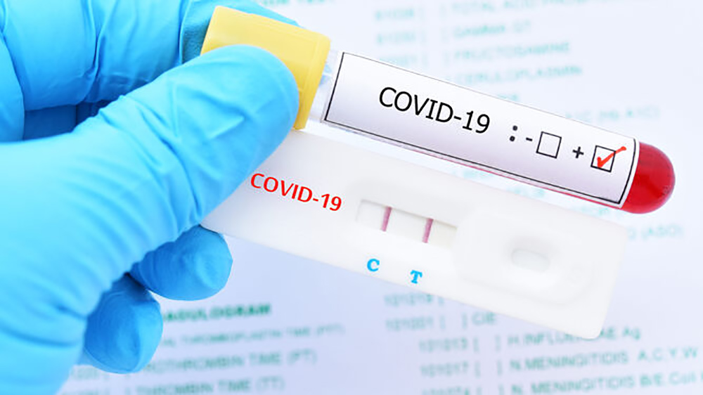 Coronavirus: hoy, 10 fallecidos y 2.561 nuevos casos positivos por COVID-19 en Canarias